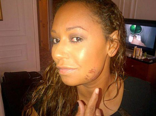 Mel B tố từng bị chồng ép sex tập thể